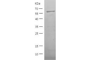 Western Blotting (WB) image for ELAV (Embryonic Lethal, Abnormal Vision, Drosophila)-Like 2 (Hu Antigen B) (ELAVL2) (AA 1-346) protein (His-IF2DI Tag) (ABIN7122757) (ELAVL2 Protein (AA 1-346) (His-IF2DI Tag))