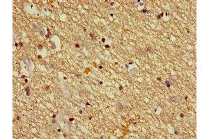 Immunohistochemistry of paraffin-embedded human brain tissue using ABIN7149930 at dilution of 1:100
