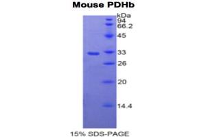 SDS-PAGE analysis of Mouse PDHb Protein.