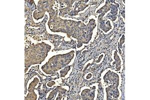 IHC analysis of Aldolase/ALDOA using anti-Aldolase/ALDOA antibody (ABIN7601908). (ALDOA anticorps  (AA 50-364))