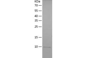 Western Blotting (WB) image for Protein Kinase C, eta (PRKCH) (AA 614-674) protein (His tag) (ABIN7124654)