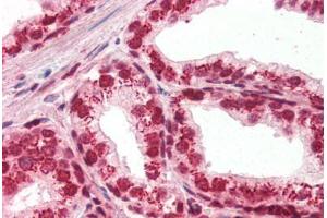 Human Prostate (formalin-fixed, paraffin-embedded) stained with APEX1 antibody ABIN396973 at 1:250 followed by biotinylated goat anti-rabbit IgG secondary antibody ABIN481713, alkaline phosphatase-streptavidin and chromogen. (APEX1 anticorps)