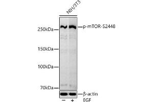Western blot analysis of extracts of NIH/3T3 cells, using Phospho-mTOR-S2448 antibody (ABIN7268435) at 1:1000 dilution.