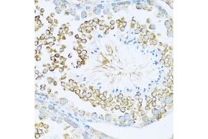 Immunohistochemistry of paraffin-embedded mouse testis using DVL1 antibody (ABIN7266796) at dilution of 1:100 (40x lens). (DVL1 anticorps  (AA 510-640))