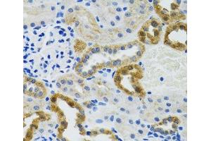 Immunohistochemistry of paraffin-embedded Mouse kidney using POLG2 Polyclonal Antibody at dilution of 1:100 (40x lens). (POLG2 anticorps)