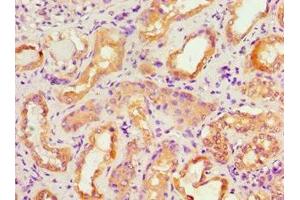 Immunohistochemistry of paraffin-embedded human kidney tissue using ABIN7143106 at dilution of 1:100 (ACTR3B anticorps  (AA 189-418))