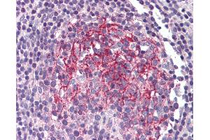 Anti-IL1R2 antibody IHC of human small intestine, Peyer's patch. (IL1R2 anticorps)