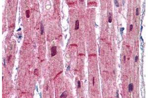 Human Heart: Formalin-Fixed, Paraffin-Embedded (FFPE) (ACTN2 anticorps  (AA 215-500))