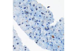 Immunohistochemistry of paraffin-embedded mouse pancreas using T Rabbit mAb (ABIN7270729) at dilution of 1:100 (40x lens).