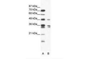 Image no. 1 for anti-Zinc Finger Protein 577 (ZNF577) (AA 373-422) antibody (ABIN202626) (ZNF577 anticorps  (AA 373-422))
