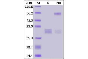 Fed Human CD8A&CD8B Heterodimer Protein, His Tag&Tag Free on  under reducing (R) and ing (NR) conditions.