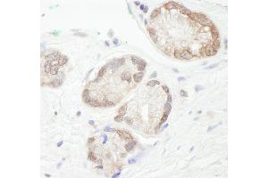 Immunohistochemistry (IHC) image for anti-Ubiquitin-Conjugating Enzyme E2L 3 (UBE2L3) (C-Term) antibody (ABIN7453475)