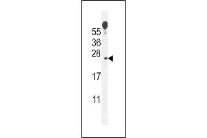 ECOP Antibody (Center) (ABIN655147 and ABIN2844768) western blot analysis in mouse lung tissue lysates (35 μg/lane). (VOPP1 anticorps  (AA 65-95))