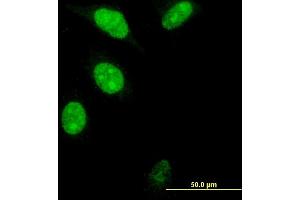 Immunofluorescence of monoclonal antibody to FOXM1 on HeLa cell. (FOXM1 anticorps  (AA 22-110))