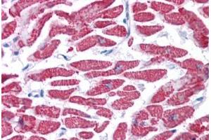 Human Heart: Formalin-Fixed, Paraffin-Embedded (FFPE)