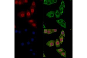 ABIN7093236 and ABIN7097248 staining Hela cells(heat shock treatment) by IF/ICC. (FOXO3 anticorps  (acLys271))