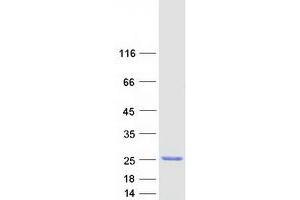 Validation with Western Blot