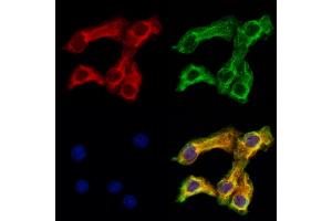 ABIN6261040 and ABIN6273217 staining Hela cells by IF/ICC. (CRLS1 anticorps  (Internal Region))