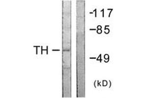 Western Blotting (WB) image for anti-Tyrosine Hydroxylase (TH) (AA 5-54) antibody (ABIN2888712) (Tyrosine Hydroxylase anticorps  (AA 5-54))