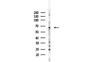 Western blot analysis of lysates from PC12 cells(LPS, 4h treatment), using NYREN18 Antibody at 1/1000 dilution.