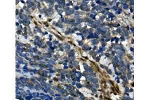 IHC analysis of RBPMS using anti-RBPMS antibody (ABIN7602120).