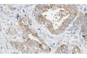 ABIN6279342 at 1/100 staining Human prostate tissue by IHC-P. (PLA2G4F anticorps  (C-Term))
