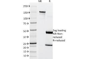 SDS-PAGE Analysis Purified MITF Mouse Monoclonal Antibody (SPM290). (MITF anticorps)