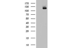 Western Blotting (WB) image for anti-ADAM Metallopeptidase with Thrombospondin Type 1 Motif, 1 (ADAMTS1) (AA 412-644) antibody (ABIN2715714) (ADAMTS1 anticorps  (AA 412-644))