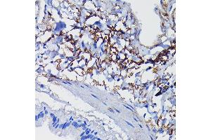 Immunohistochemistry of paraffin-embedded human lung using Clusterin alpha chain Rabbit pAb (ABIN6133477, ABIN6138756, ABIN6138758 and ABIN6216721) at dilution of 1:100 (40x lens).