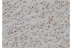 ABIN6278978 at 1/100 staining Human lung tissue by IHC-P.