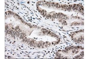 Image no. 9 for anti-Ubiquitin Specific Peptidase 5 (USP5) antibody (ABIN1501693)