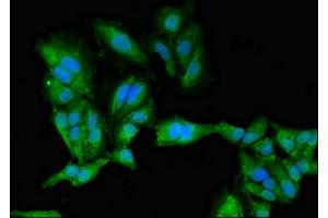 Immunofluorescent analysis of Hela cells using ABIN7146602 at dilution of 1:100 and Alexa Fluor 488-congugated AffiniPure Goat Anti-Rabbit IgG(H+L)