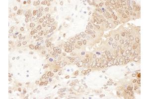 Immunohistochemistry (IHC) image for anti-Acetyl-CoA Acetyltransferase 2 (ACAT2) (AA 150-200) antibody (ABIN7454576) (ACAT2 anticorps  (AA 150-200))
