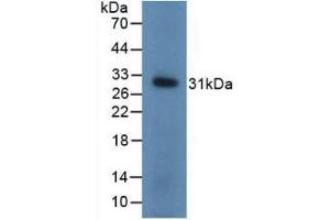 Detection of Recombinant UCHL1, Mouse using Polyclonal Antibody to Ubiquitin Carboxyl Terminal Hydrolase L1 (UCHL1)
