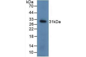 Detection of Recombinant UCHL1, Mouse using Polyclonal Antibody to Ubiquitin Carboxyl Terminal Hydrolase L1 (UCHL1) (UCHL1 anticorps  (AA 2-223))