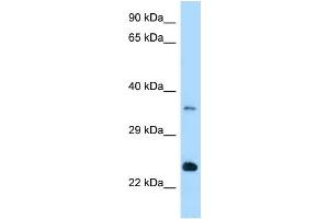 WB Suggested Anti-Rab13 Antibody Titration: 1. (RAB13 anticorps  (Middle Region))