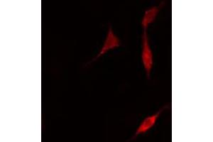 ABIN6266510 staining A549 cells by IF/ICC. (Claudin 5 anticorps  (C-Term))