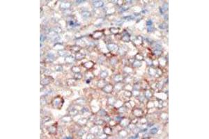 Image no. 2 for anti-Phosphoinositide 3-kinase Regulatory Subunit 4 (PIK3R4) (N-Term) antibody (ABIN360462)