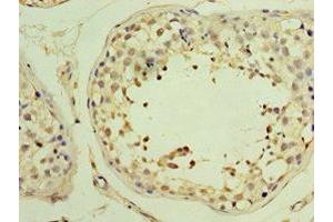 Immunohistochemistry of paraffin-embedded human testis tissue using ABIN7174000 at dilution of 1:100 (YARS2 anticorps  (AA 228-477))