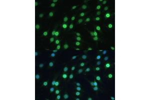 Immunofluorescence analysis of C6 cells using LBR Polyclonal Antibody (ABIN6128194, ABIN6143105, ABIN6143106 and ABIN6221130) at dilution of 1:100 (40x lens).