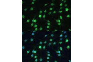 Immunofluorescence analysis of C6 cells using LBR Polyclonal Antibody (ABIN6128194, ABIN6143105, ABIN6143106 and ABIN6221130) at dilution of 1:100 (40x lens). (Lamin B Receptor anticorps  (AA 1-211))