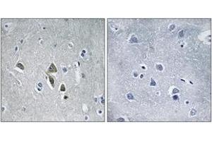 Immunohistochemistry (IHC) image for anti-Ornithine Decarboxylase Antizyme 1 (OAZ1) (AA 14-63) antibody (ABIN2890479) (OAZ1 anticorps  (AA 14-63))