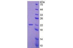 SDS-PAGE analysis of Mouse ADM Protein. (Adrenomedullin Protein (ADM))