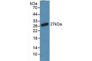 Western blot analysis of recombinant Rat RANk. (TNFRSF11A anticorps  (AA 31-214))