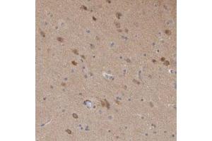 Immunohistochemical staining (Formalin-fixed paraffin-embedded sections) of human cerebral cortex with SCRN1 polyclonal antibody  shows moderate cytoplasmic positivity in neuronal cells. (Secernin 1 anticorps)