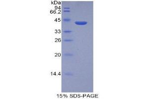 SDS-PAGE (SDS) image for Histone Cluster 2, H2aa3 (HIST2H2AA3) (AA 1-130) protein (His tag,GST tag) (ABIN1821788)