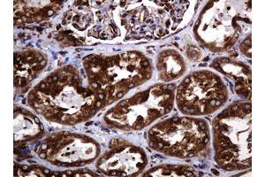 Image no. 10 for anti-Pogo Transposable Element with KRAB Domain (POGK) antibody (ABIN1500329)