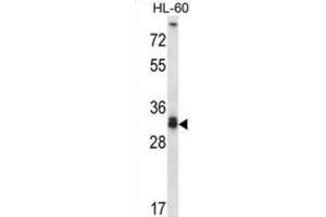 Western Blotting (WB) image for anti-Syntaxin 6 (STX6) antibody (ABIN2998481) (Syntaxin 6 anticorps)