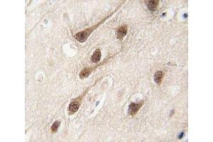IHC analysis of FFPE human brain tissue stained with RUNX1 antibody (RUNX1 anticorps  (AA 227-255))