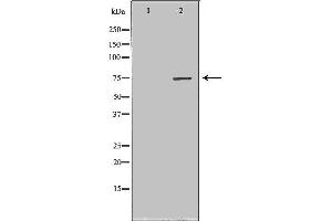 Western blot analysis of extracts of Mouse fetal kidney tissue lysate, using CPT2 antibody. (CPT2 anticorps  (Internal Region))